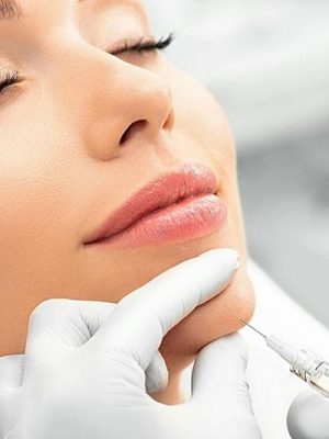 Dermal fillers